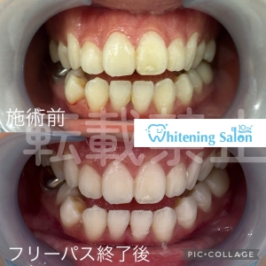 【歯と顎の健康の秘密とは】