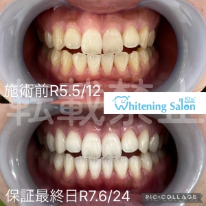 【健康的な歯で過ごすためには】