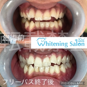 【季節ごとのおすすめ口腔ケア】