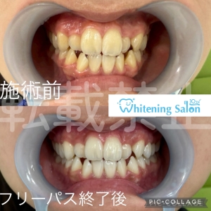 【食べやすさは唾液に影響する？】