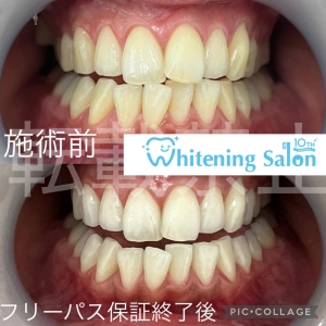 【歯の健康に欠かせないカルシウム】