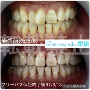 【歯ブラシを交換する頻度】