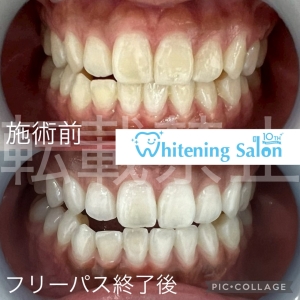 【秋の乾燥が口臭に影響？】