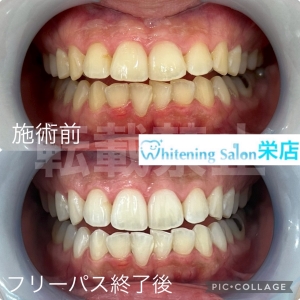 【顎関節症の症状と原因】