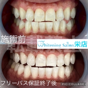 【口呼吸はなぜダメなのか】