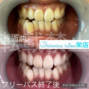 【歯茎にできる口内炎は病気？】