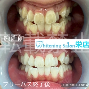 【丁寧な仕上げ磨きのコツ】