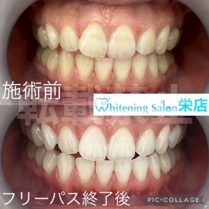 【歯列不正の種類と特徴】