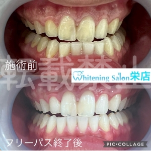 【歯垢をキレイに落とす正しい歯磨き方法】