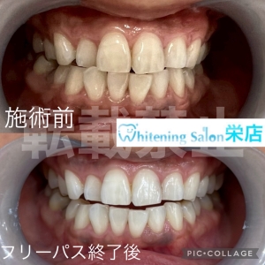 【妊婦さんと歯周病の関係性】名古屋栄/ホワイトニング