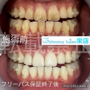 【睡眠とお口の健康の関係】名古屋栄/ホワイトニング