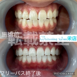 【歯周病になりやすい人の生活習慣は...?】名古屋栄/ホワイトニング