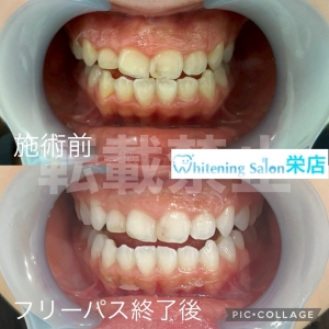 【正しい歯磨き粉の選び方】名古屋栄/ホワイトニング