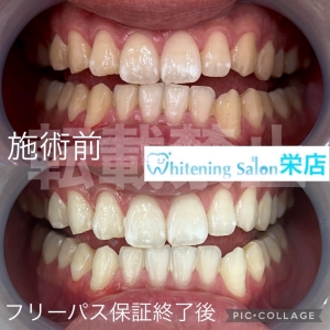【噛み合わせと歯並びの関係性】名古屋栄/ホワイトニング