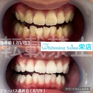 【口の中で起こる病気の種類】名古屋栄/ホワイトニング