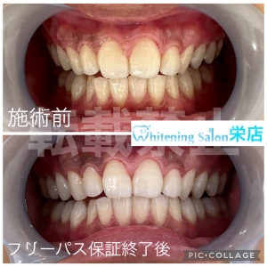 【歯茎の状態でわかるお口の健康】名古屋栄/ホワイトニング
