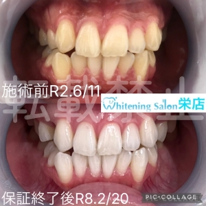 【歯が綺麗な人の特徴とは】名古屋栄/ホワイトニング